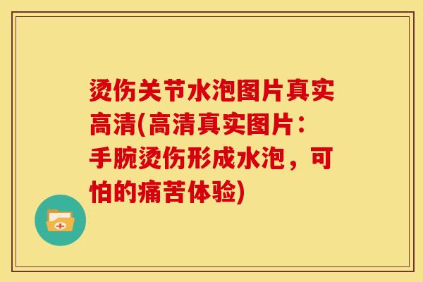 烫伤关节水泡图片真实高清(高清真实图片：手腕烫伤形成水泡，可怕的痛苦体验)