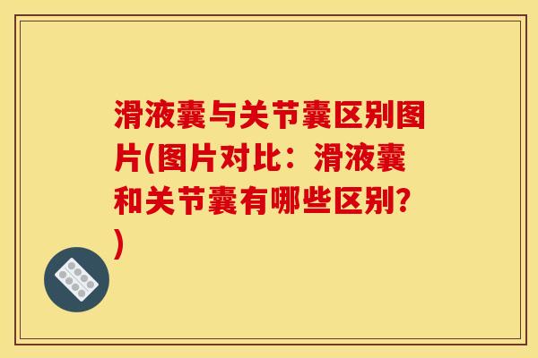 滑液囊与关节囊区别图片(图片对比：滑液囊和关节囊有哪些区别？)