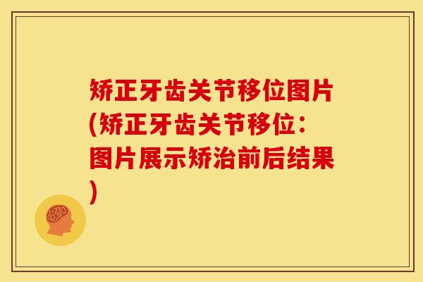 矫正牙齿关节移位图片(矫正牙齿关节移位：图片展示矫治前后结果)