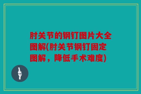 肘关节的钢钉图片大全图解(肘关节钢钉固定图解，降低手术难度)