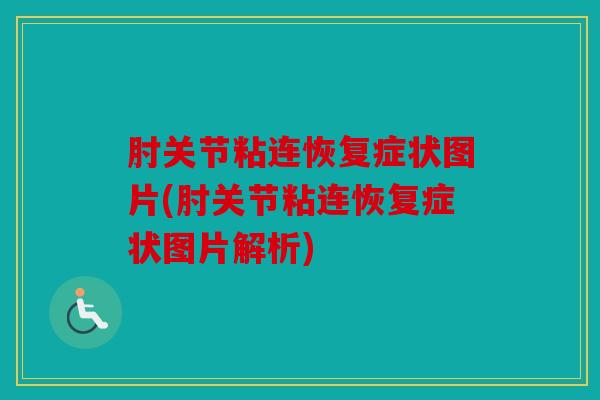 肘关节粘连恢复症状图片(肘关节粘连恢复症状图片解析)
