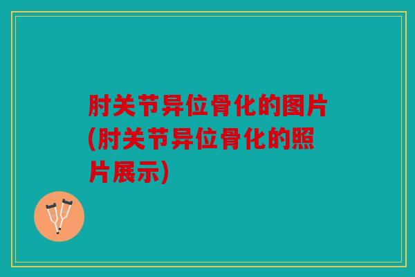 肘关节异位骨化的图片(肘关节异位骨化的照片展示)