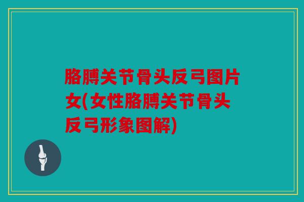 胳膊关节骨头反弓图片女(女性胳膊关节骨头反弓形象图解)