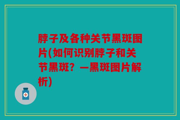 脖子及各种关节黑斑图片(如何识别脖子和关节黑斑？—黑斑图片解析)