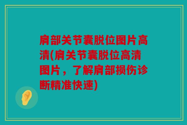 肩部关节囊脱位图片高清(肩关节囊脱位高清图片，了解肩部损伤诊断精准快速)