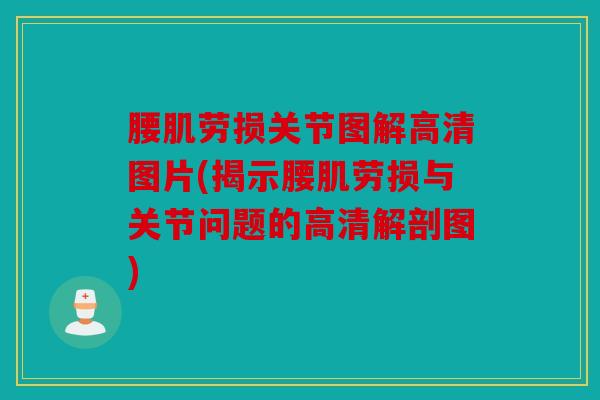 腰肌劳损关节图解高清图片(揭示腰肌劳损与关节问题的高清解剖图)