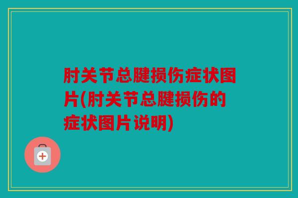 肘关节总腱损伤症状图片(肘关节总腱损伤的症状图片说明)