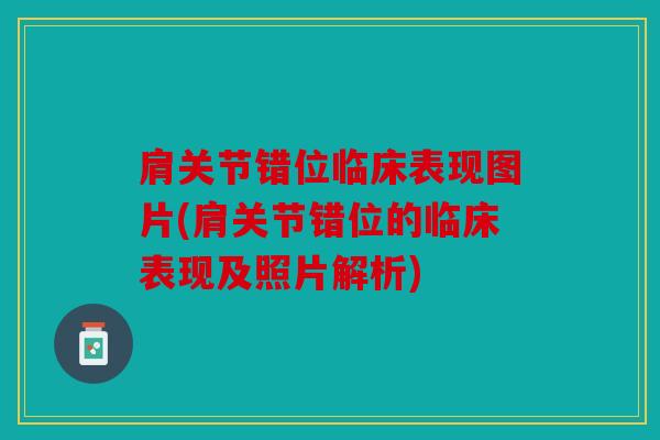 肩关节错位临床表现图片(肩关节错位的临床表现及照片解析)