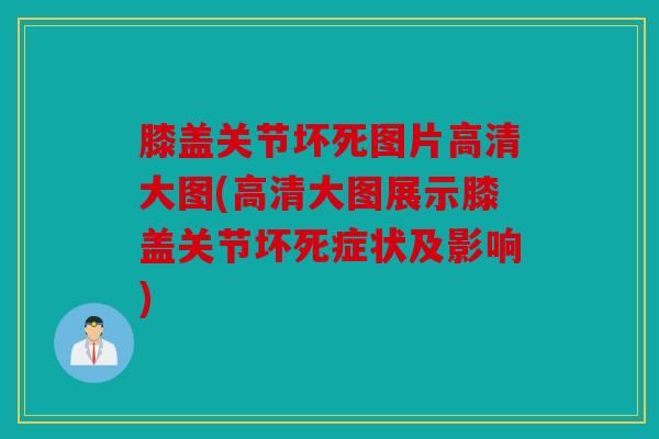 膝盖关节坏死图片高清大图(高清大图展示膝盖关节坏死症状及影响)