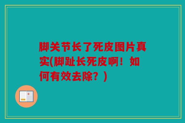 脚关节长了死皮图片真实(脚趾长死皮啊！如何有效去除？)