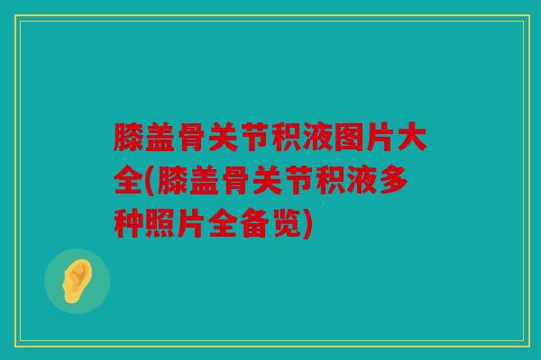 膝盖骨关节积液图片大全(膝盖骨关节积液多种照片全备览)