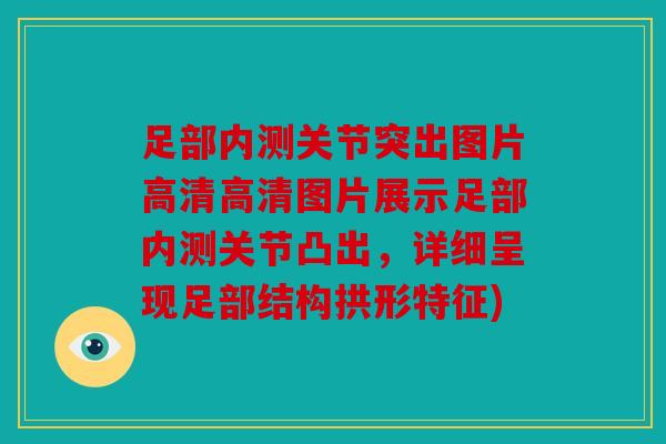 足部内测关节突出图片高清高清图片展示足部内测关节凸出，详细呈现足部结构拱形特征)