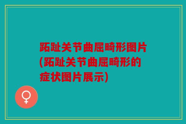 跖趾关节曲屈畸形图片(跖趾关节曲屈畸形的症状图片展示)