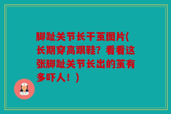 脚趾关节长干茧图片(长期穿高跟鞋？看看这张脚趾关节长出的茧有多吓人！)