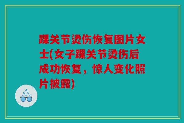 踝关节烫伤恢复图片女士(女子踝关节烫伤后成功恢复，惊人变化照片披露)
