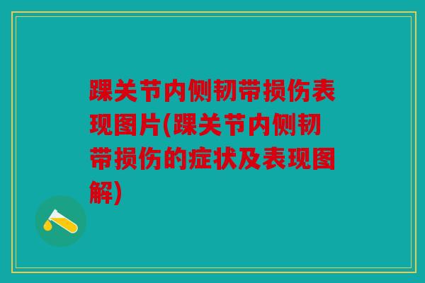 踝关节内侧韧带损伤表现图片(踝关节内侧韧带损伤的症状及表现图解)