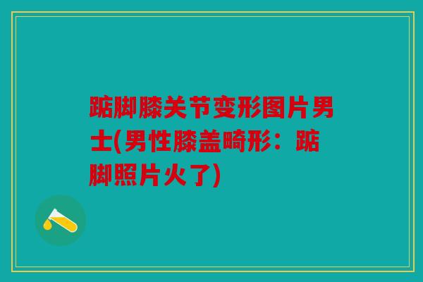 踮脚膝关节变形图片男士(男性膝盖畸形：踮脚照片火了)