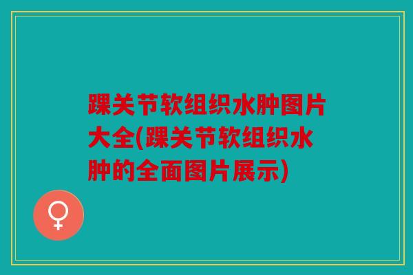 踝关节软组织水肿图片大全(踝关节软组织水肿的全面图片展示)