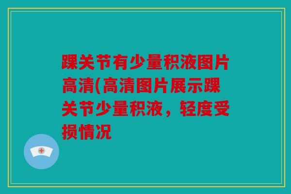 踝关节有少量积液图片高清(高清图片展示踝关节少量积液，轻度受损情况